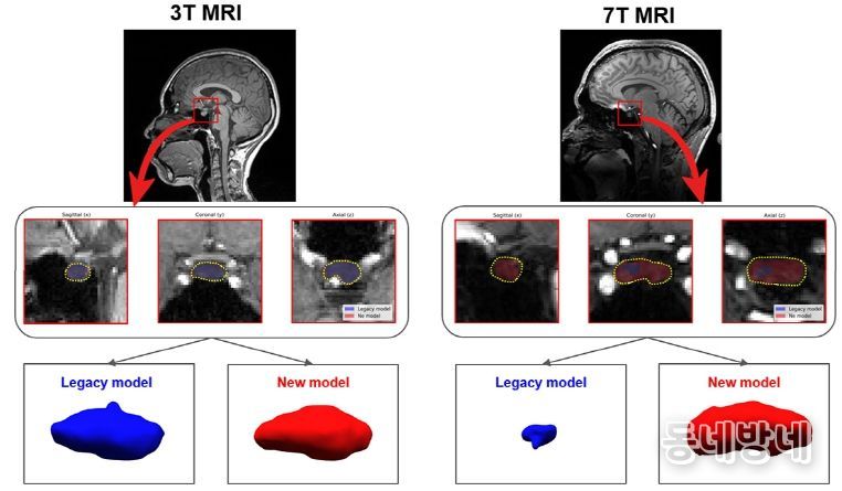 대한내분비학회서 ‘우수구연발표상’ 영예